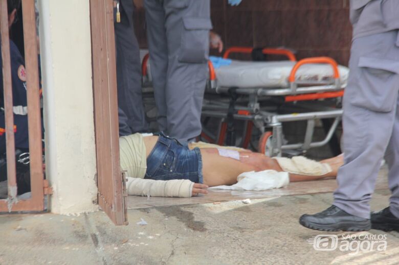 Mulher sofre queimaduras nas pernas e nas mãos - Crédito: Maycon Maximino