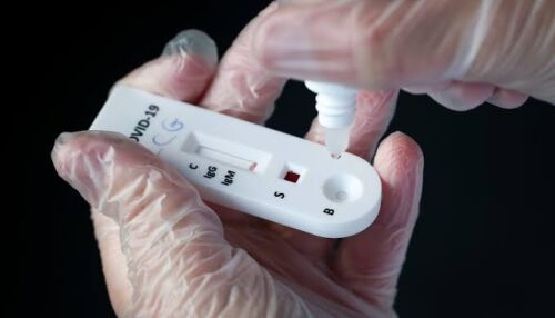 São Carlos registra 47 casos positivos de Covid-19 em fevereiro