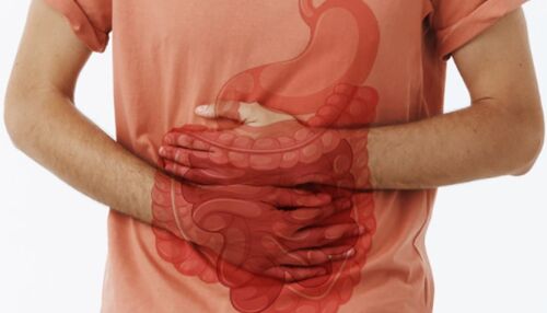 Inflamação intestinal ativa aumenta risco de distúrbios do sono, ansiedade e depressão, aponta estudo da USP