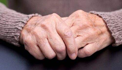 Pesquisa de doutorado da UFSCar recruta voluntários com artrose nas mãos para estudo sobre avaliação e exercícios terapêuticos