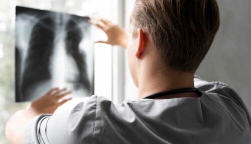 Anvisa aprova novo medicamento para tratamento de câncer de pulmão