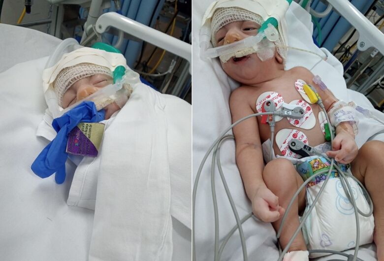 Mãe de bebê com síndrome rara implora por leito de UTI em São Carlos