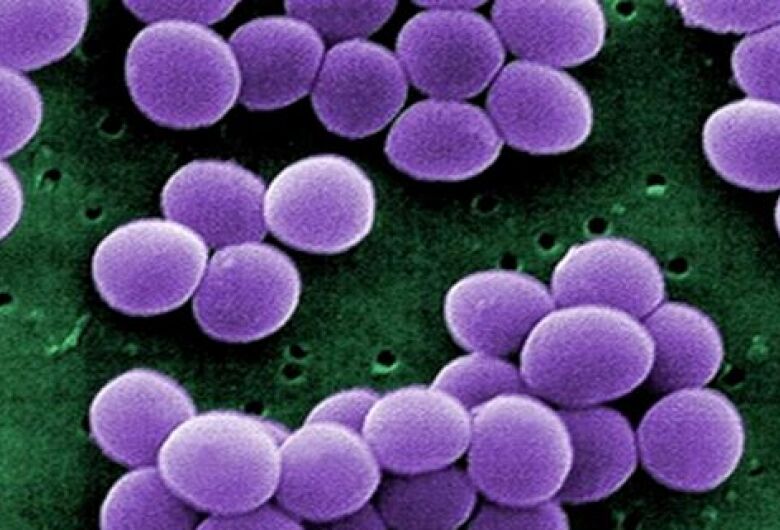 Trabalho Científico da Equipe do CEPOF – INCT – IFSC - USP no combate a bactérias resistentes é destaque na American Physical Society