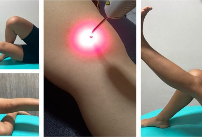 Laser em pontos de acupuntura (laserpuntura) associado ao exercício físico no tratamento da dor no joelho