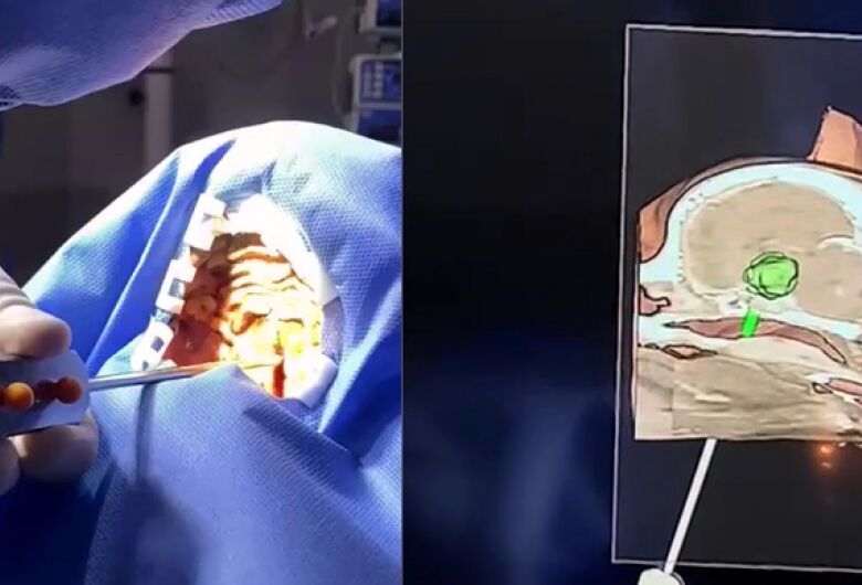 Startup criada em laboratório da USP desenvolve neuronavegador que auxilia em cirurgias veterinárias