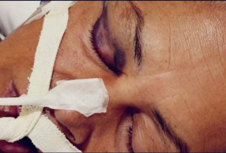 Mulher agredida ao tentar separar briga de casal morre na região