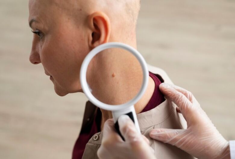 Diagnósticos de câncer de pele crescem mais de 1.500% em dez anos e escancaram desigualdade no acesso ao tratamento