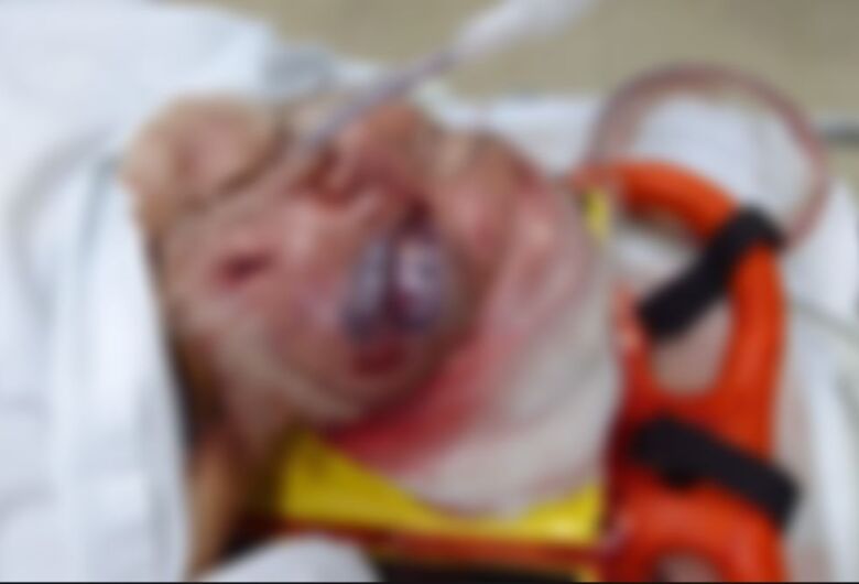 Idoso agredido com martelo pela companheira segue internado em estado grave na UTI 