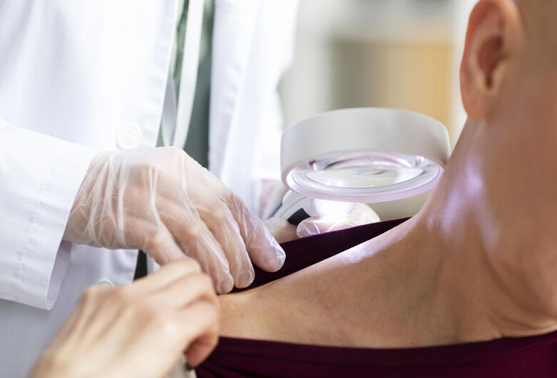 Você sabe o que é carcinoma basocelular?