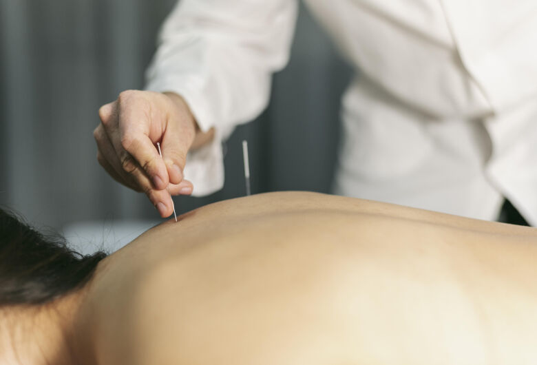 Acupuntura ganha espaço no tratamento da dor e conquista respaldo cientÃfico