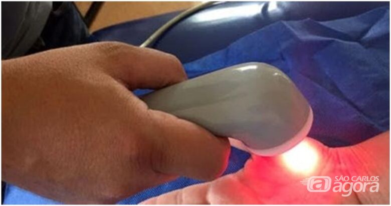 Momento da aplicação com equipamento que emite o ultrassom e o laser terapêutico de forma simultânea na mão do paciente com fibromialgia - Crédito: Divulgação
