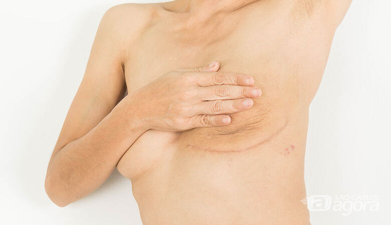 Projeto da UFSCar atende mulheres que passaram por cirurgia de câncer de mama - Crédito: Divulgação