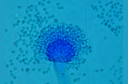 Aspergillus fumigatus, responsável por mais de 90% dos casos de aspergilose pulmonar invasiva - Crédito: LIFE - www.life-worldwide.org
