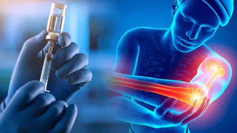 Anvisa alerta sobre casos raros de Guillain-Barré após vacinação - Crédito: divulgação