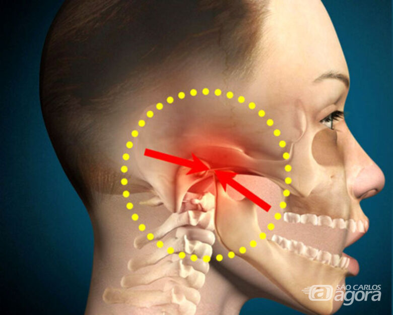 Terapia com uso de laser pode melhorar dores na mandíbula – Jornal da USP