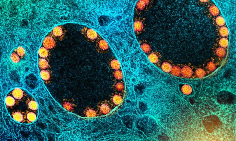 Pandemias futuras podem ser mais mortais e contagiosas, diz cientista - Crédito: © NIAID