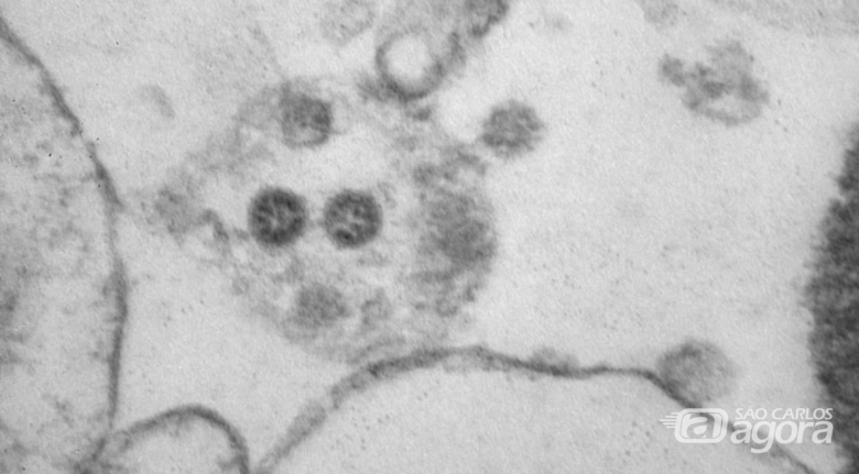 Imagem da variante Ômicron divulgada por cientistas russos - Crédito: Instituto Galameya/divulgação