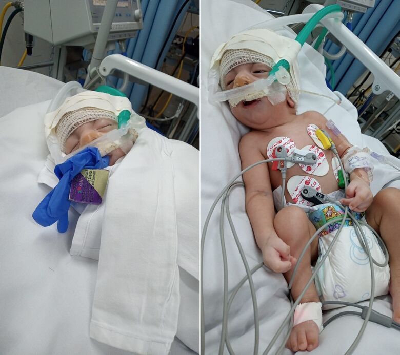 Mãe de bebê com síndrome rara implora por leito de UTI em São Carlos - Crédito: arquivo pessoal