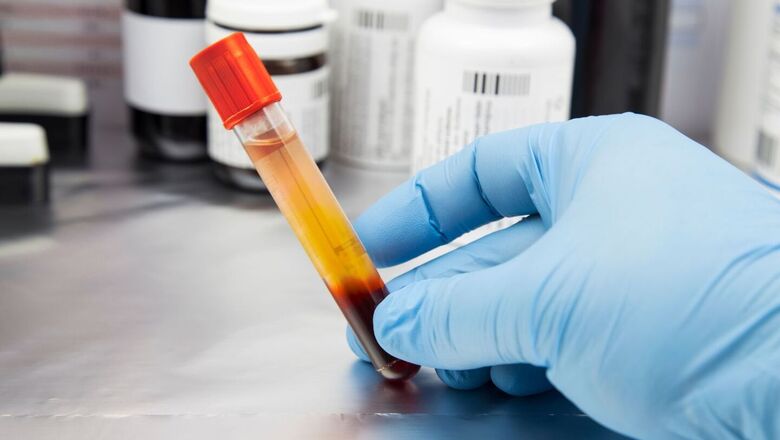Para validar a técnica, pesquisadores planejam ampliar o número de amostras de sangue a serem avaliadas e incluir novos grupos no estudo. - Crédito: IQSC