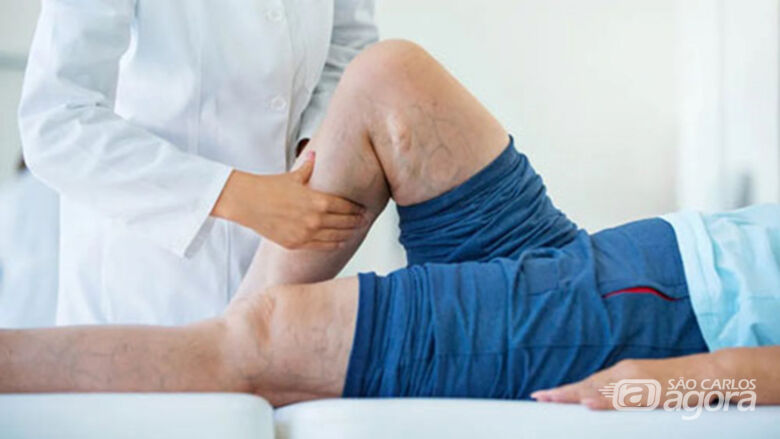 Projeto de pesquisa no CEPOF – INCT – IFSC – USP faz chamada de pacientes com problema vascular (Doença Vascular Crônica) - Crédito: (Crédito – Medical News Today)