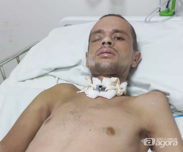 Mãe pede ajuda para filho que sofreu acidente grave em São Carlos - Crédito: Arquivo pessoal