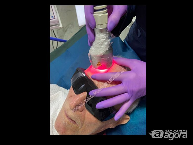 Fotobiomodulação Transcraniana com lasers vermelhos e infravermelhos (Vacum Laser, MMOptics, São Carlos, SP, Brasil) (Arquivo pessoal da autora). - 