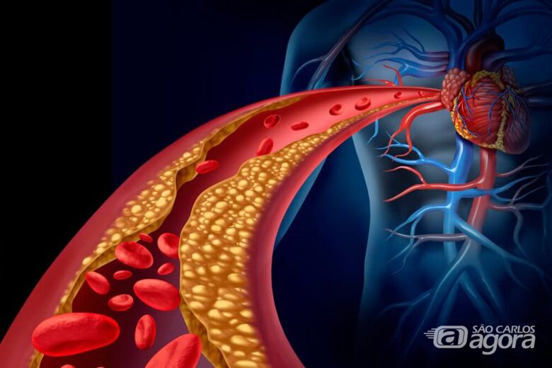 Colesterol - Crédito: reprodução Atos Brasília