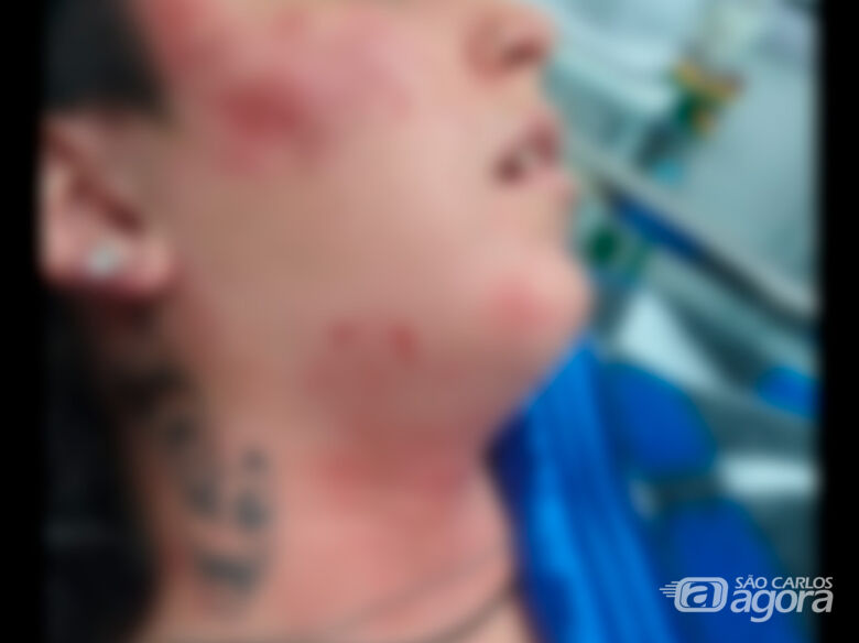 Mulher é brutalmente agredida por assaltante em Ibaté - 