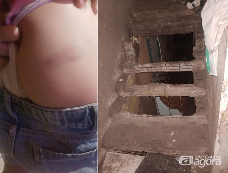 Degraus de escada se desintegram e causam acidentes no São Carlos 8 - Crédito: Whatsapp SCA