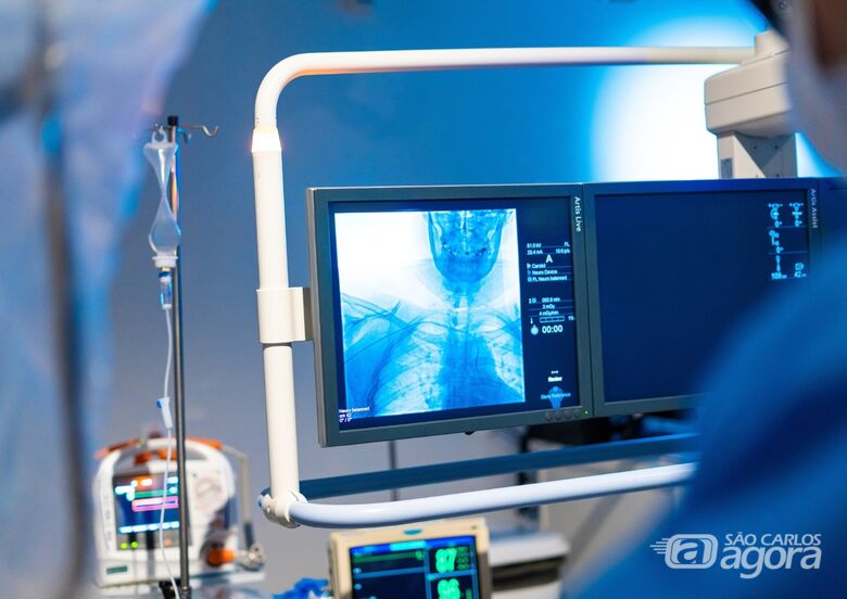 Entre os avanços proporcionados pelo novo equipamento, está a realização da angiografia cerebral - Crédito: Comunicação Santa Casa