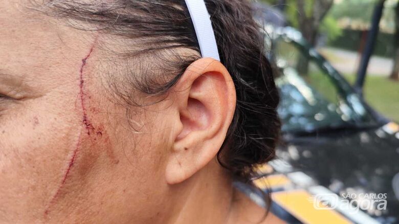 Rosto da vítima ficou machucado - Crédito: Maycon Maximino