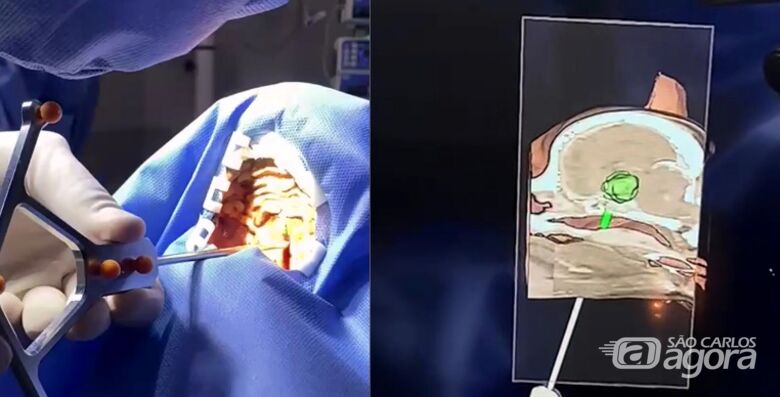 Neuronavegador em uso durante procedimento cirúrgico craniano em animal - Foto: Divulgação SVCOM/EESC -