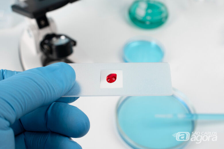 A proposta resultou na identificação de proteínas que podem ser alvos-chave para aprimorar a eficácia da terapia - Crédito: divulgação