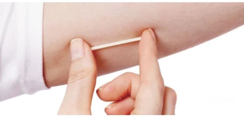 Novo implante contraceptivo será disponibilizado gratuitamente pelo SUS -