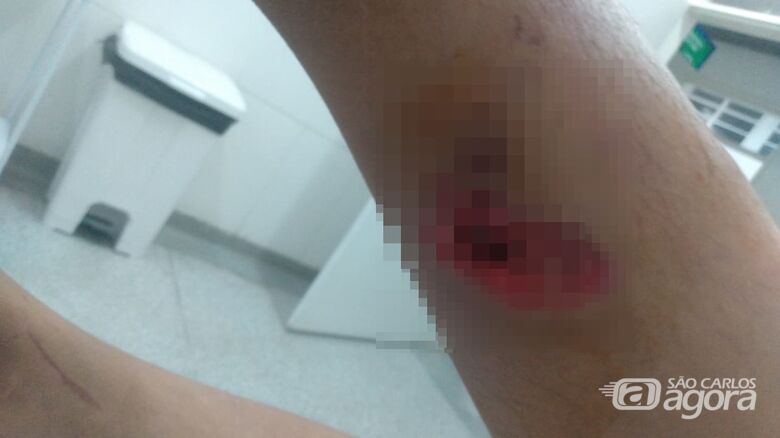 Criança de 6 anos é atacada por cachorro no Eduardo Abdelnur - 