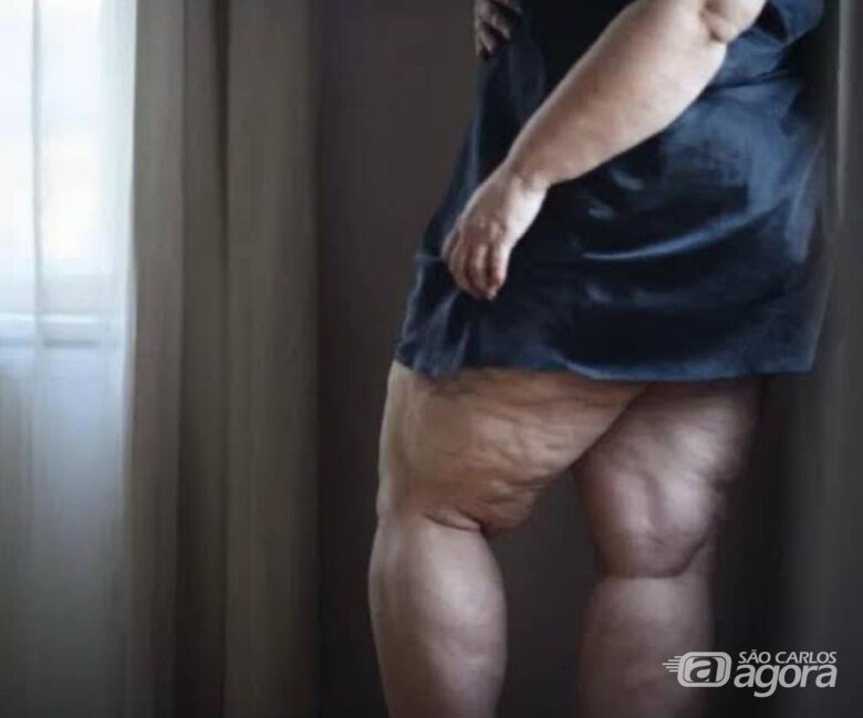 Foto Profissional - Crédito: (Crédito: pexels.com)