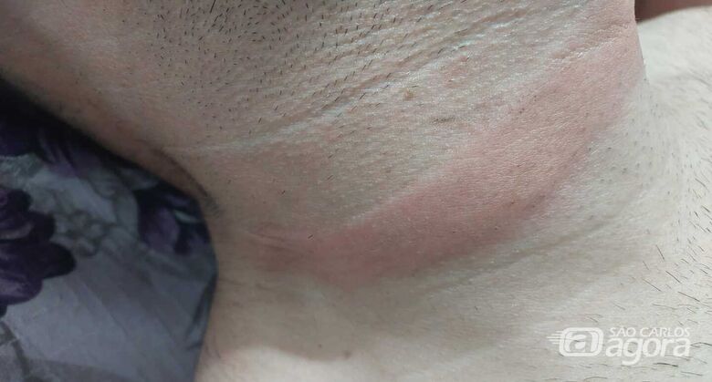 Casal de motociclistas sofre acidente com fio de internet solto no Jardim Paulista -