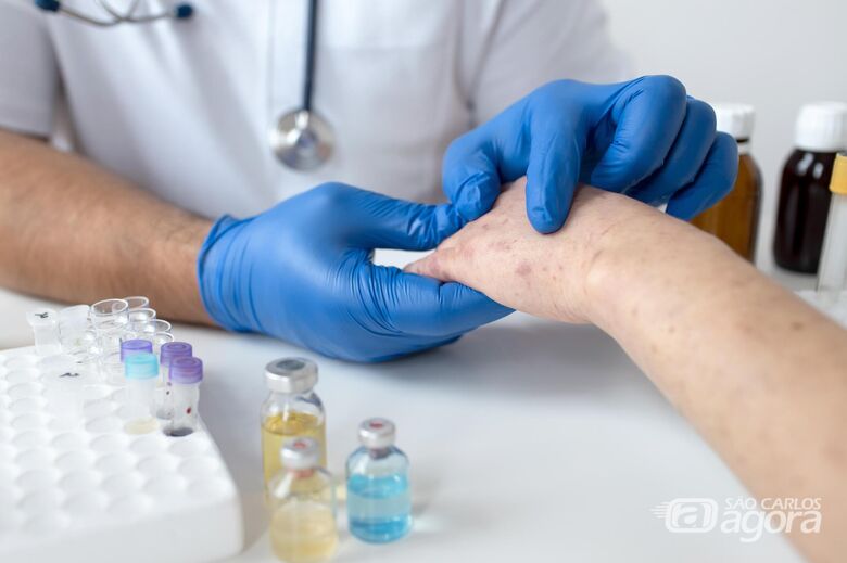 Alergia cutanea no braco de uma pessoa - Crédito: Freepik