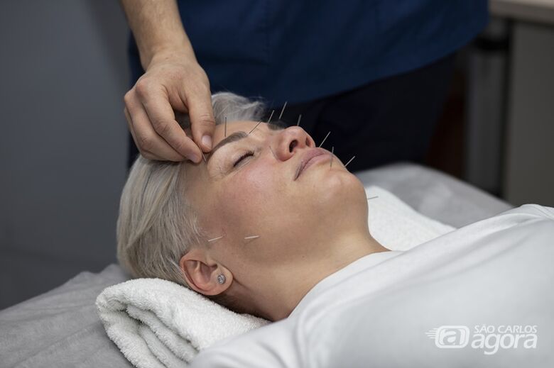 Acupuntura passa a ter regulamentação profissional no Brasil - 
