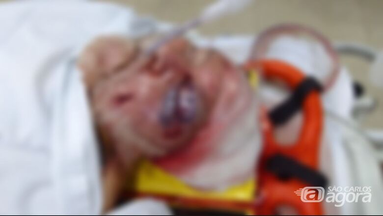 Idoso agredido com martelo pela companheira segue internado em estado grave na UTI  - Crédito: Araraquara Agora