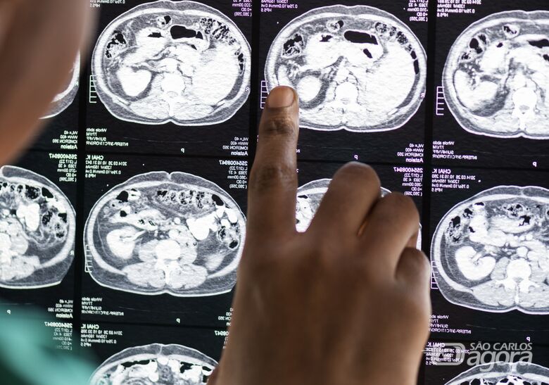 epilepsia - Crédito: Freepik