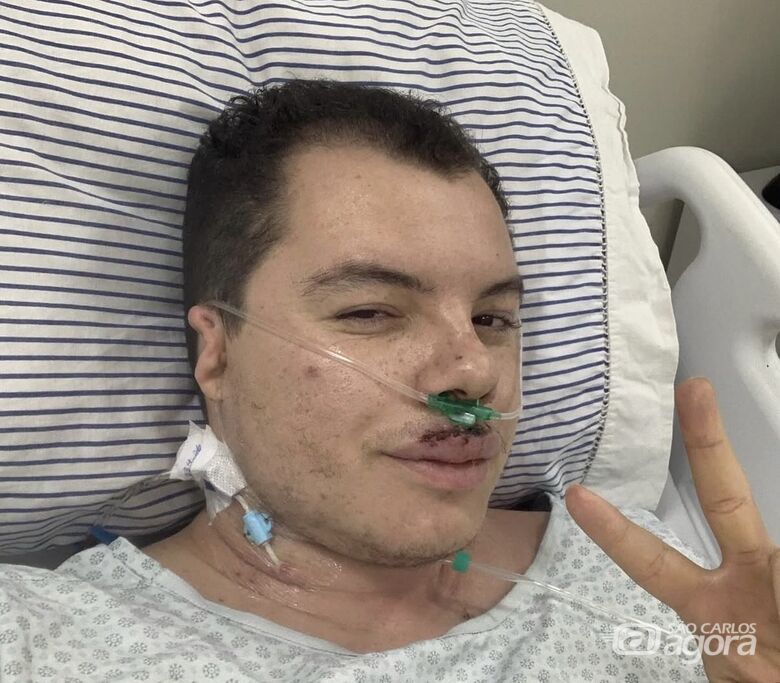 Promotor de eventos agredido após festa universitária deixa a UTI em São Carlos - Crédito: Arquivo pessoal 