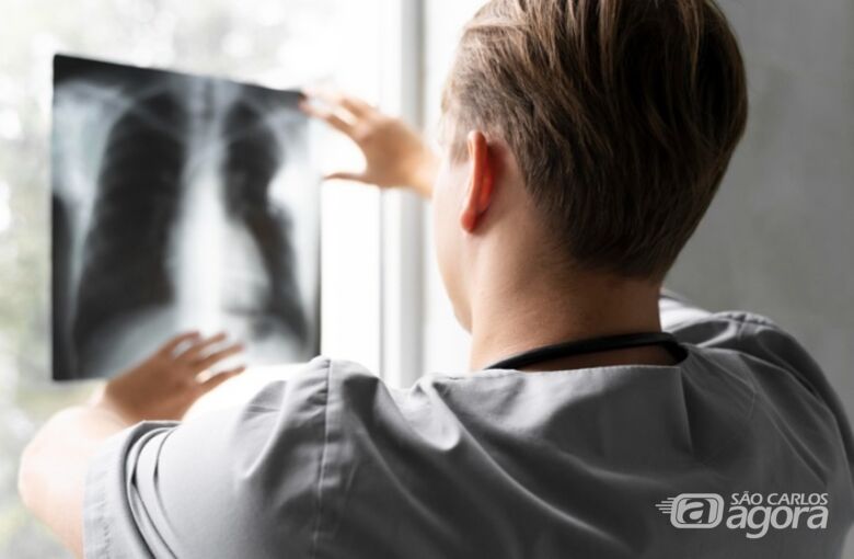 Pulmão - Crédito: Freepik