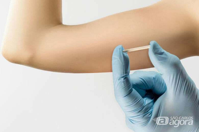 implantehormonal - Crédito: pexels