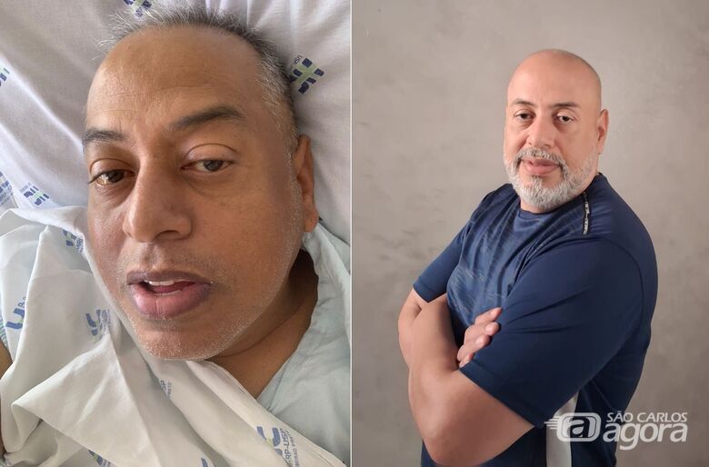 “Diga sim. Doe órgãos. Doe vida”: morador de São Carlos relata luta e renascimento após transplante de fígado - 
