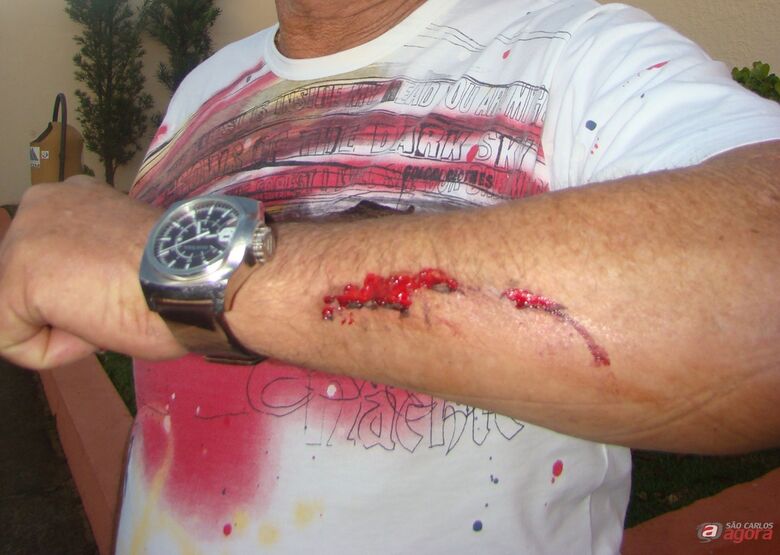 Prefeito mostra braço machucado após ser agredido. -