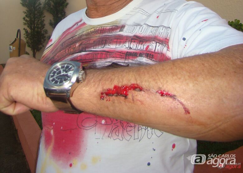 Prefeito mostra braço machucado após ser agredido. - 