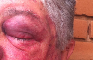Idosos foram torturados pelos criminosos (Daiane Bombarda/Tribuna Araraquara) -
