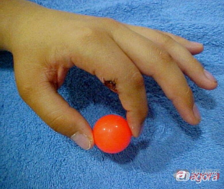 A terapia da mão é aplicada em várias situações. Foto: FAI/UFSCar - 