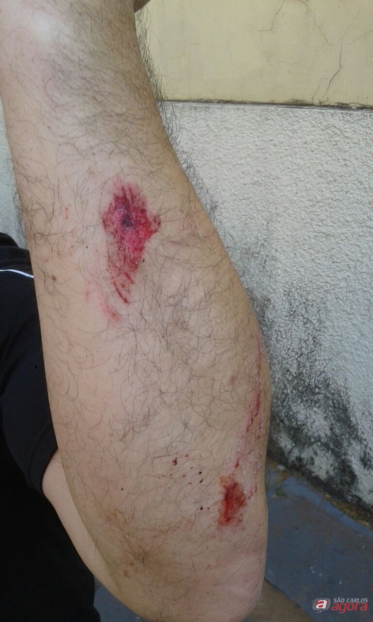 Professor ainda se feriu durante o ato de vandalismo. (foto Anderson Lucio) -